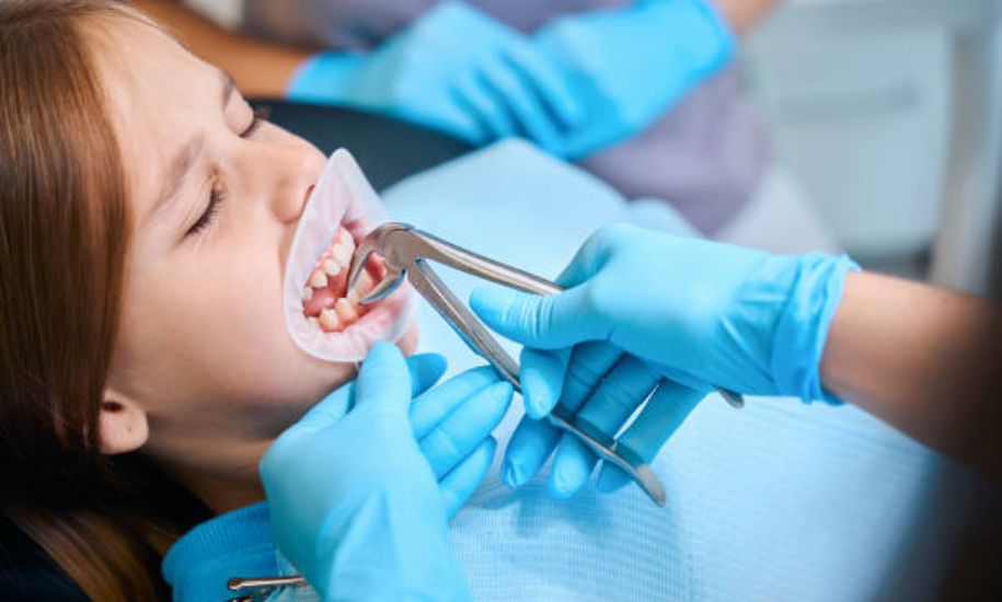 How Long To Keep Gauze in After Tooth Extraction